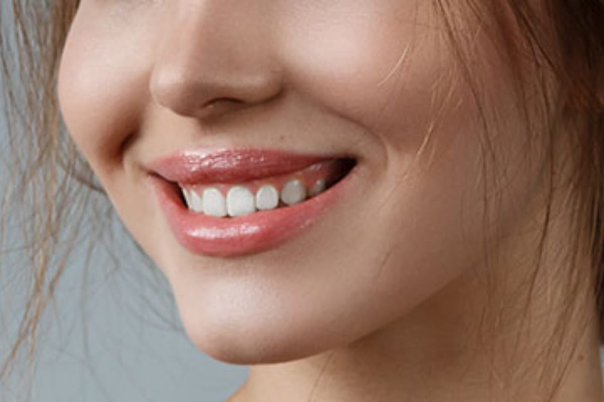 Aumento de labios con ácido hialurónico: Guía Completa