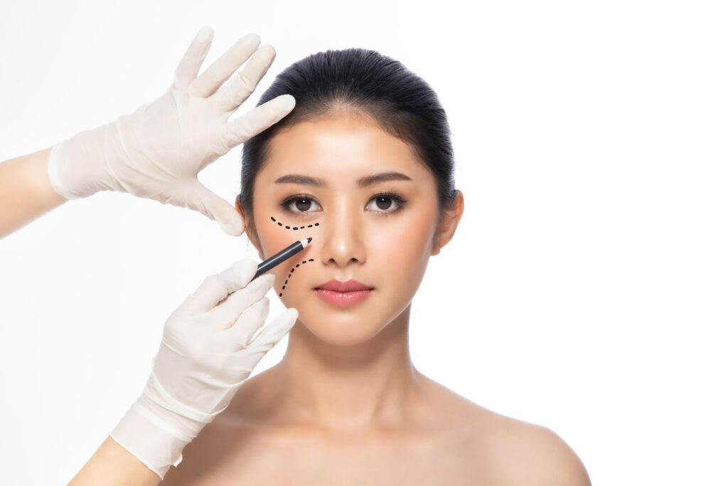 resultado Blefaroplastia